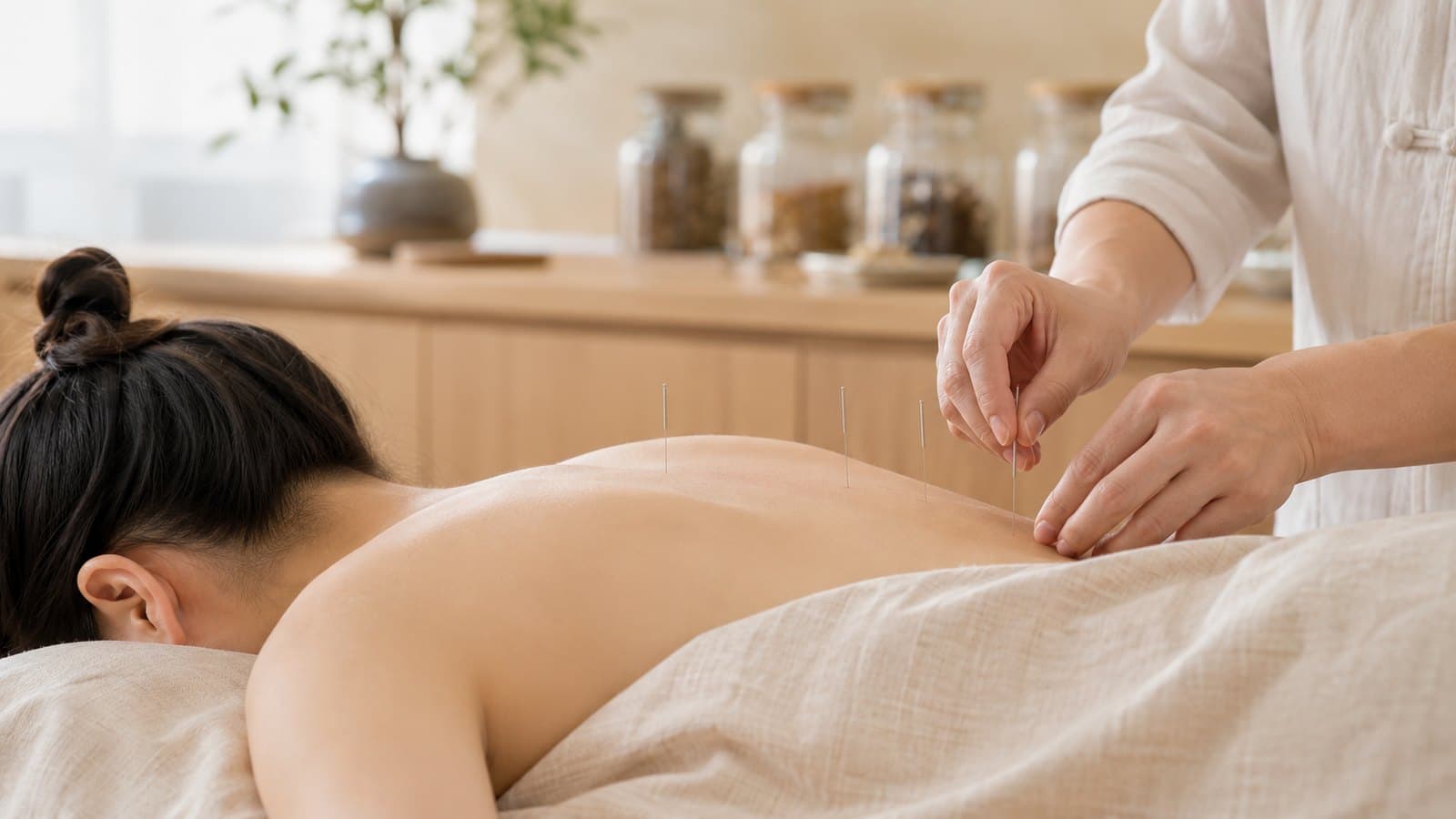 An acupuncture session — Traditional Chinese Medicine